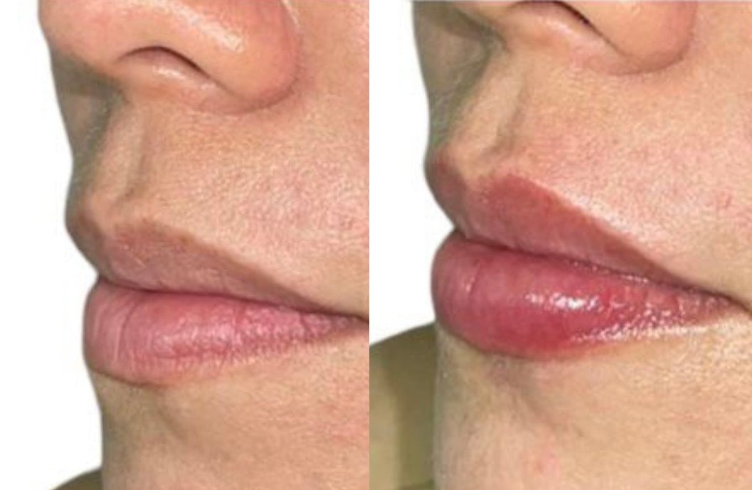 Before and After transformation