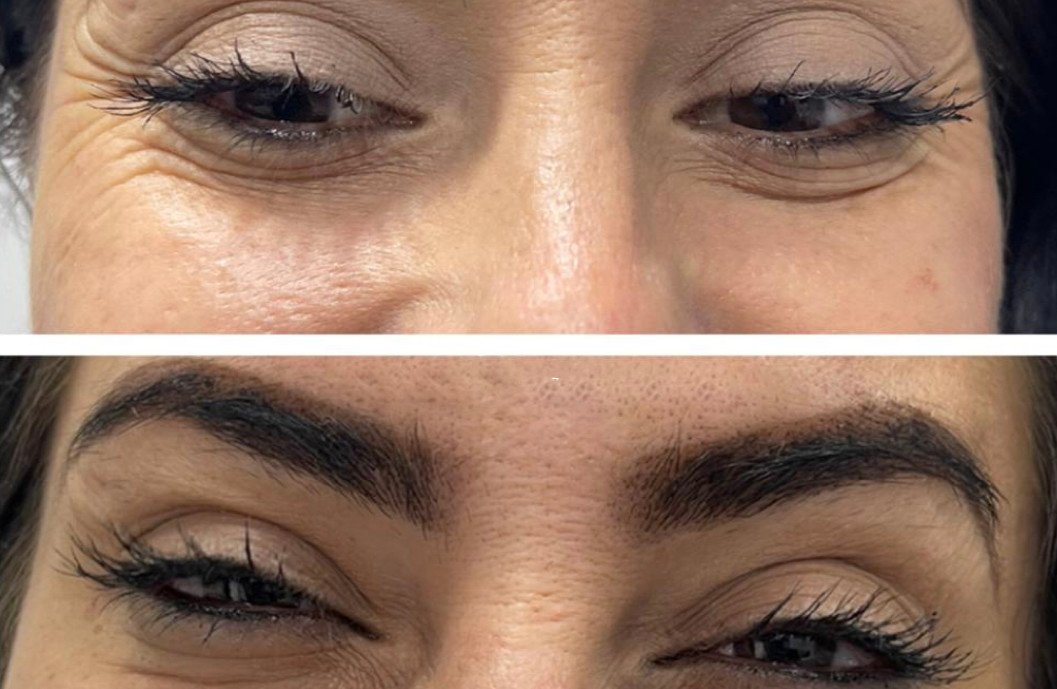 Before and After transformation