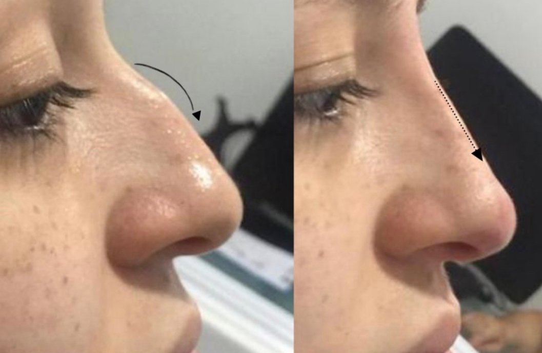 Before and After transformation