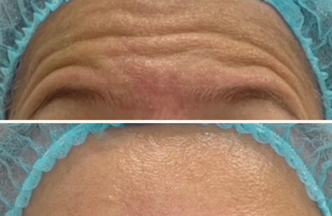 Before and After transformation