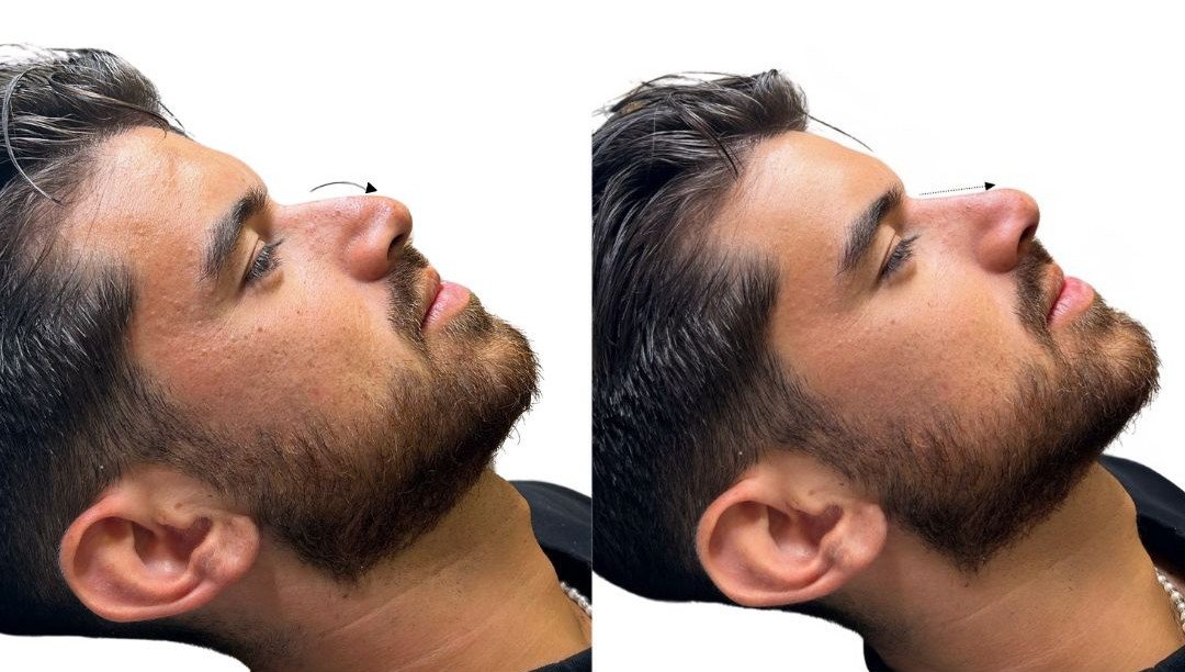 Before and After transformation
